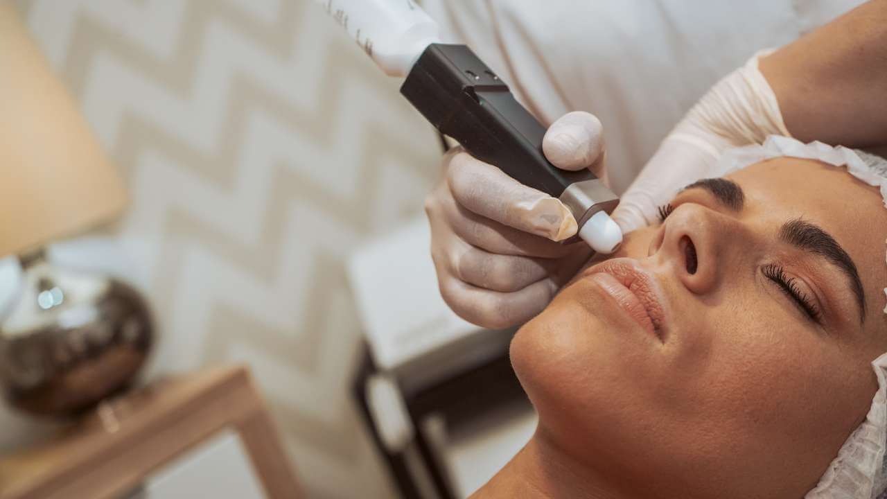 Stop Hiding Your Smile Fade Hyperpigmentation Around Mouth