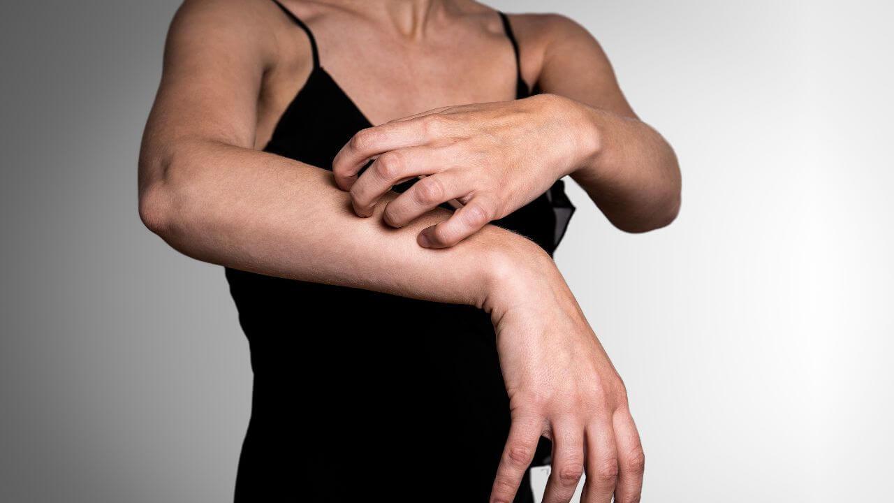 Woman scratching her arm, a common side effect of using cosmetic products with high concentrations of kojic acid.