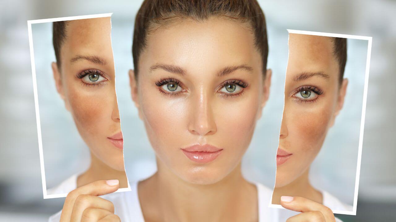 Woman reveals her top results before and after using the best body wash to reduce hyperpigmentation on her face.